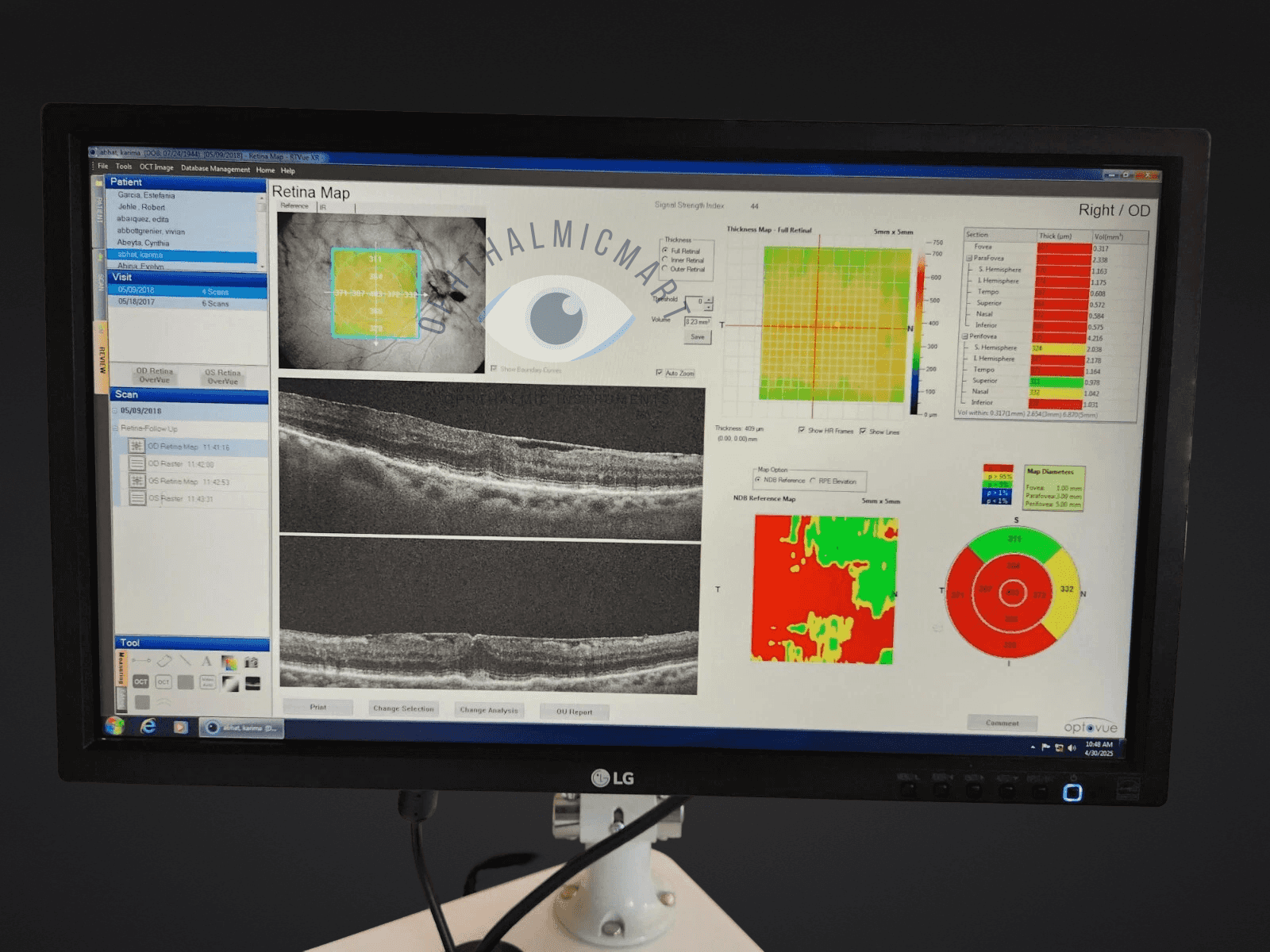 OPTOVUE Avanti SOFTWARE