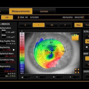 Topcon CA-800 Corneal Analyzer