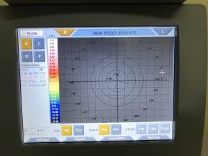 Topcon CA-200F_keratometry