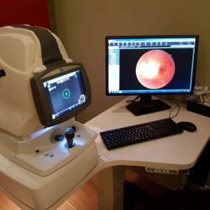 Nidek-RS-330-For-Sale-1