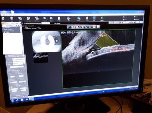 Nidek-RS-330-For-Sale-13