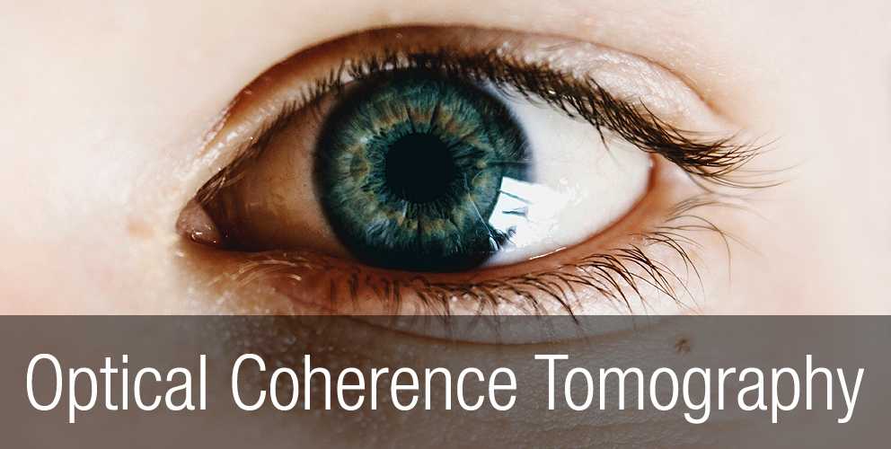 Optical-coherence-tomography-advantages
